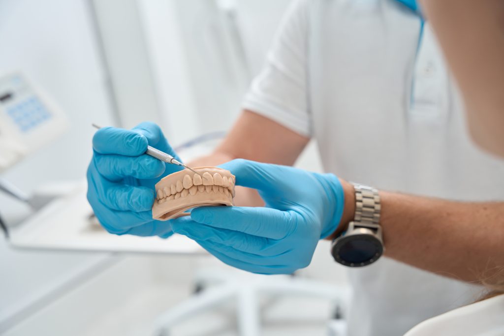 Placa Dental